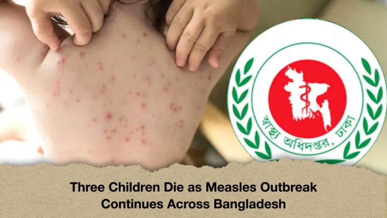 Three Children Die as Measles Outbreak Continues Across Bangladesh Three Children Die as Measles Outbreak Continues Across Bangladesh