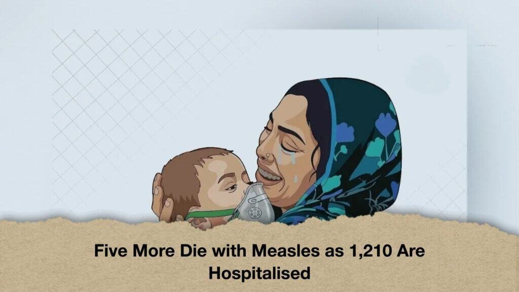 Five More Die with Measles as 1,210 Are Hospitalised
