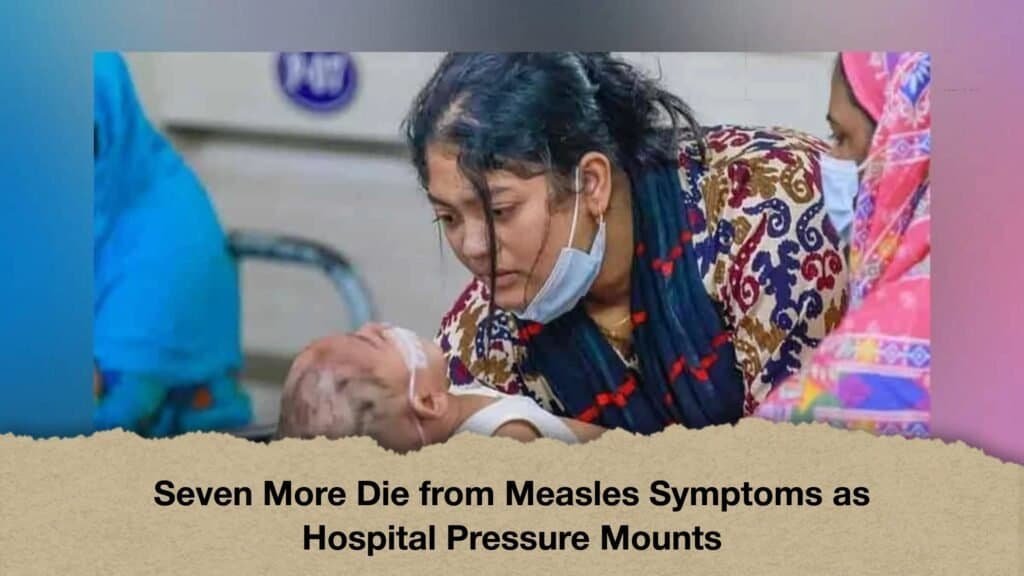 Seven More Die from Measles Symptoms as Hospital Pressure Mounts 3 Seven More Die from Measles Symptoms as Hospital Pressure Mounts